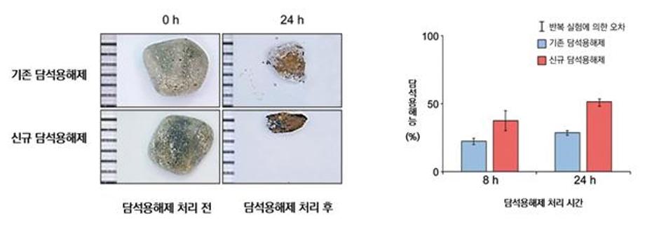 담낭 제거하지 않고 담석만 골라 녹이는 새로운 화합물 개발, 기술이전 이미지