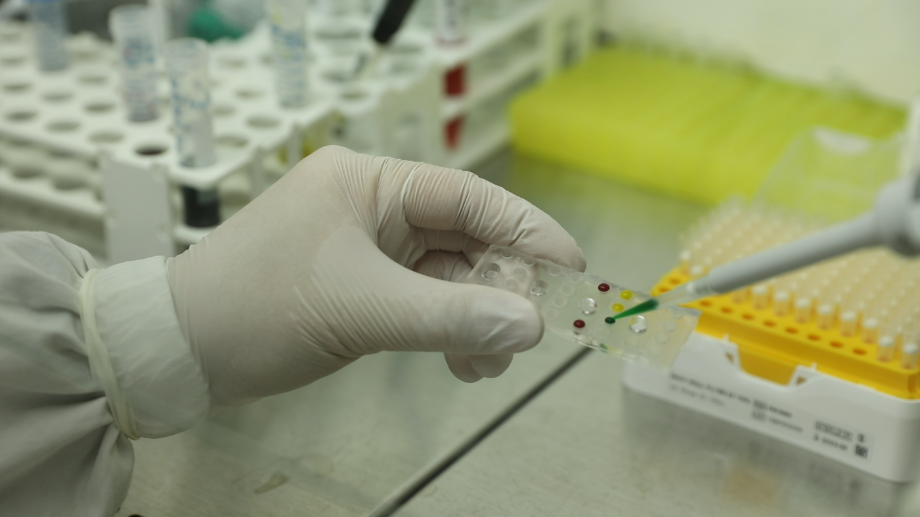 [사진 4-1]_장기칩을 이용한 호중구 이동 관찰을 위해 공통 채널 및 비교 채널1,2에 배양시킨 호중구 세포(빨간색)와 정상인 혈장(노란색)-만성염증 환자 혈장(녹색)을 주입하는 모습